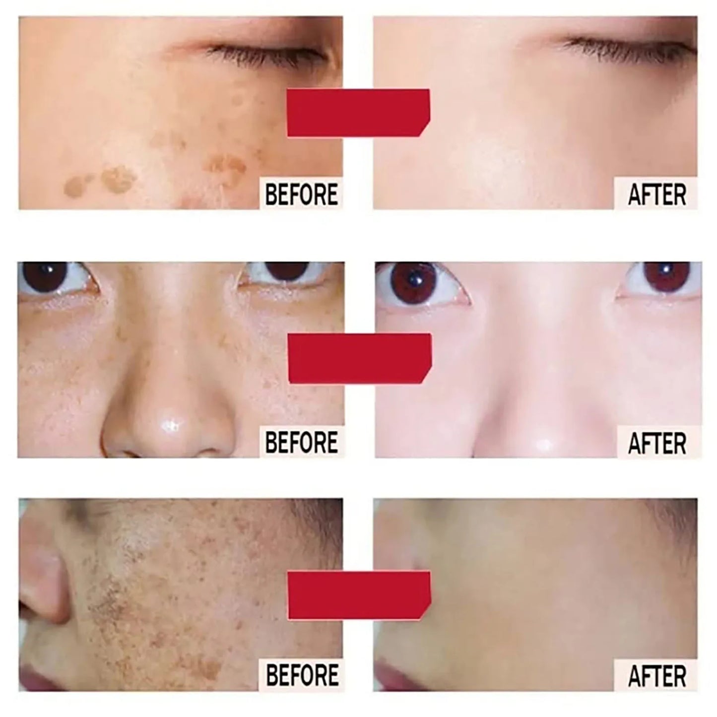 AILKE Lightenin Anti-Wrinkle Face Cream With Collagen, Hyaluronic Acid, Whitening Skin Care Women Facial Moisturizer Set